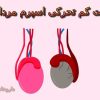 کم تحرکی اسپرم مردان