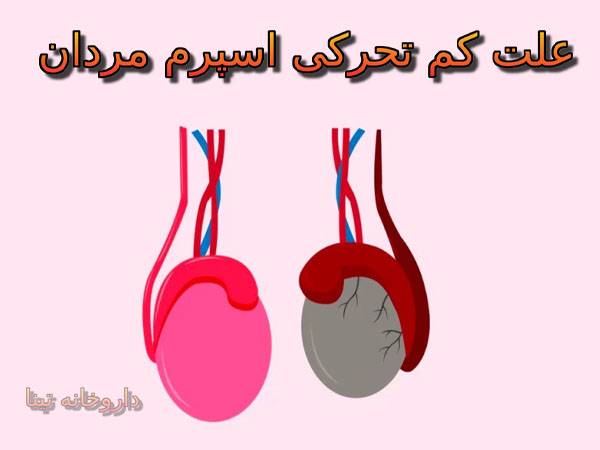 علت کم تحرکی اسپرم مردان | علائم و دلایل